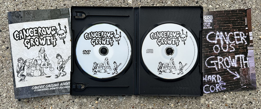Cancerous Growth - "Discography" CD/DVD